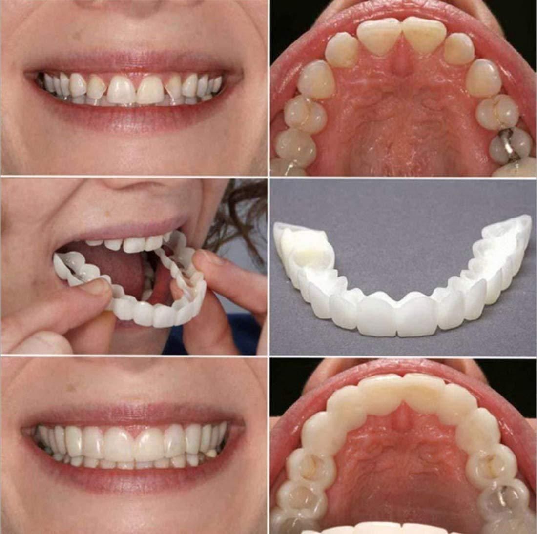 Smile Fit Flex – Instant Cosmetic Denture Teeth