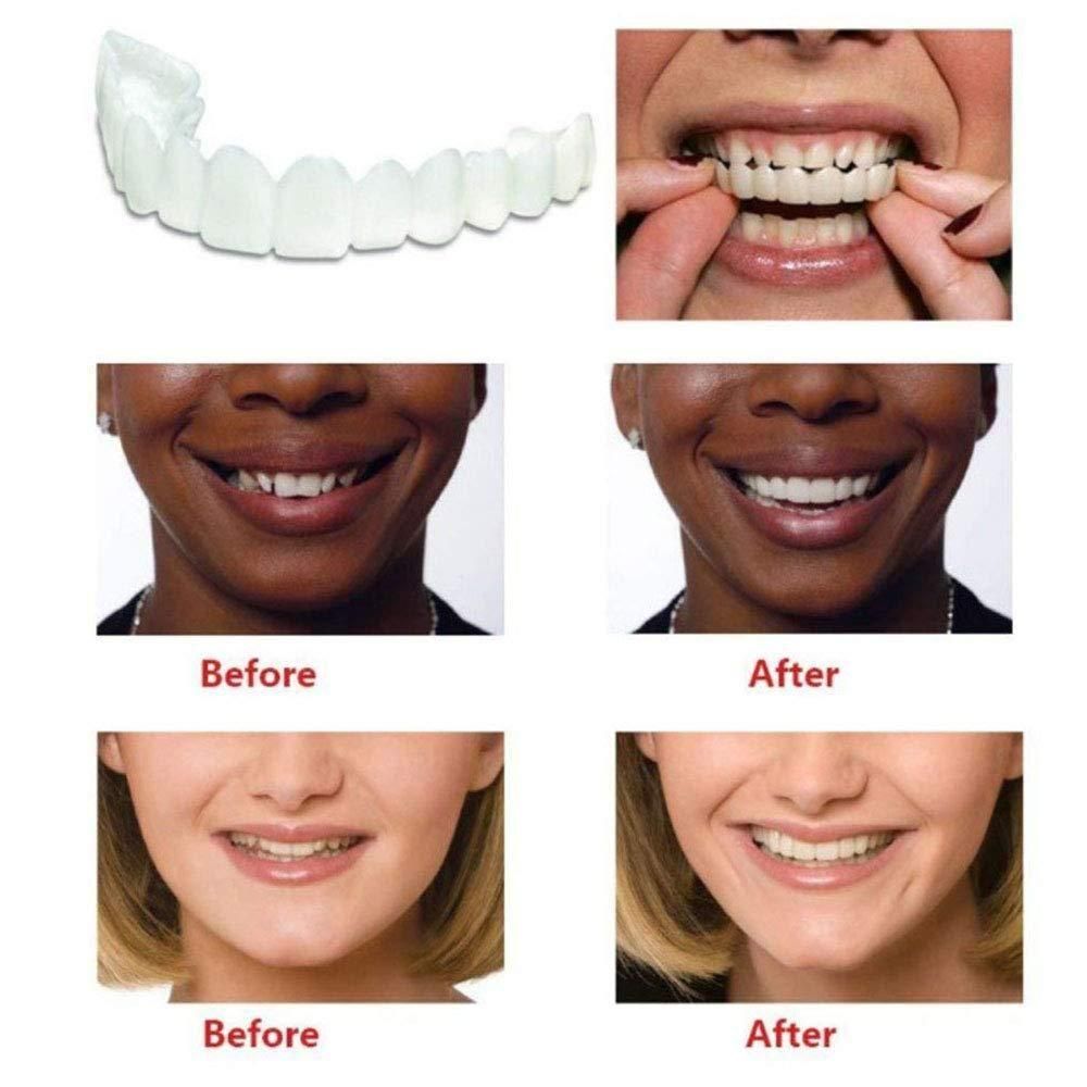 Smile Fit Flex – Instant Cosmetic Denture Teeth